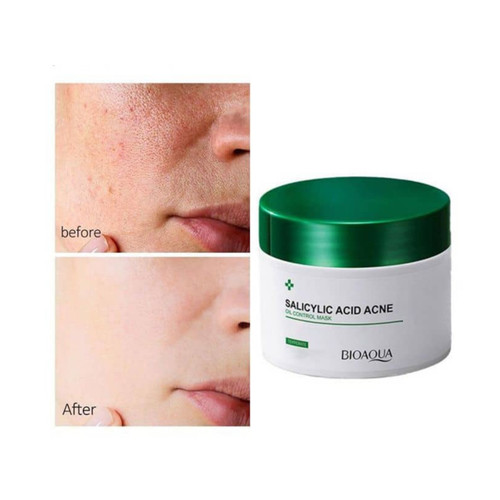ژل اسکراب لایه بردار ضد جوش و آکنه کاسه ای سالسیلیک اسید بیوآکوا